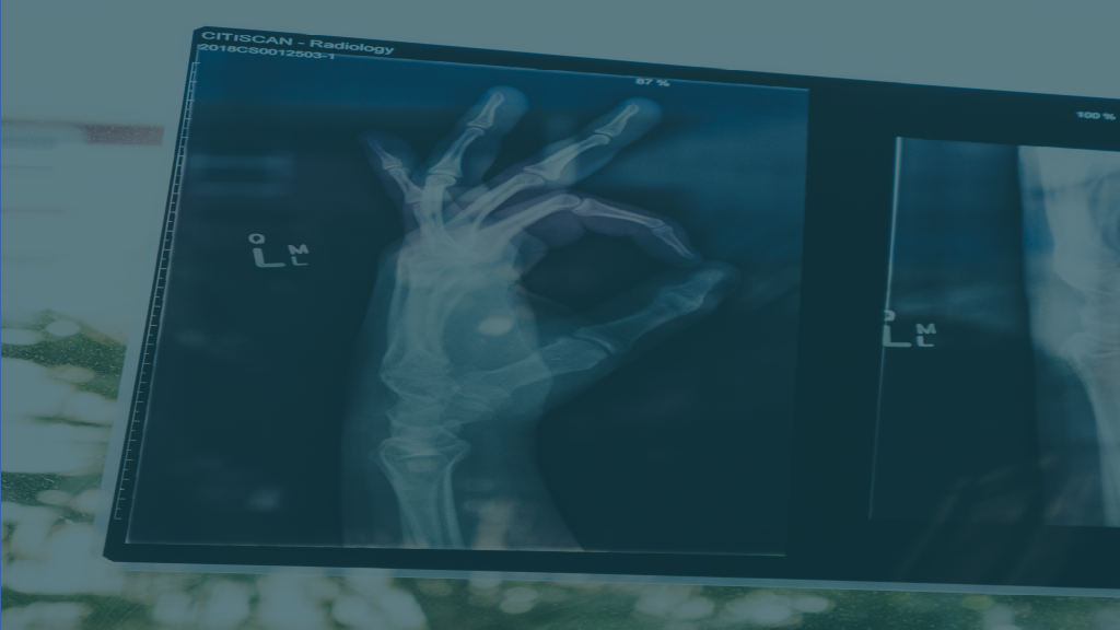 Datenleck(s)? im Gesundheitswesen - Weltweites Problem